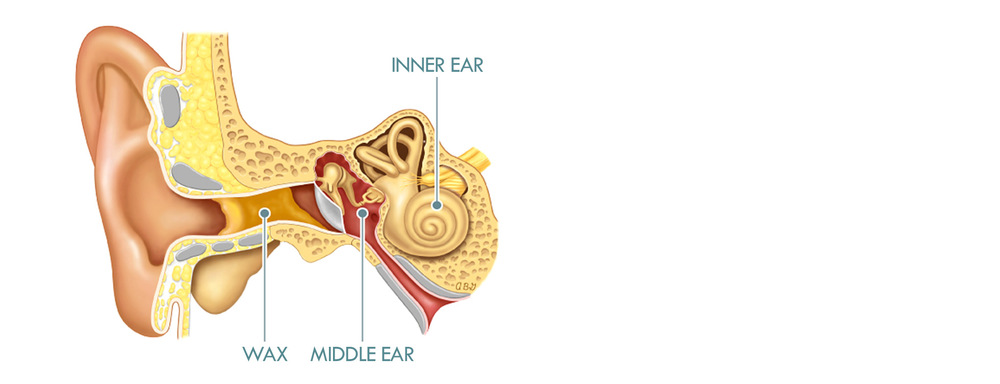 ear wax removal, micro suction, microsuction, ear wax, earwax removal, clear ears, blocked ears, poor hearing 